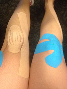 Kinesio Taping
