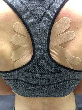 Kinesio Taping